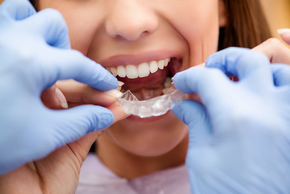 ortodoncia invisible en clínica dental ferrocarril