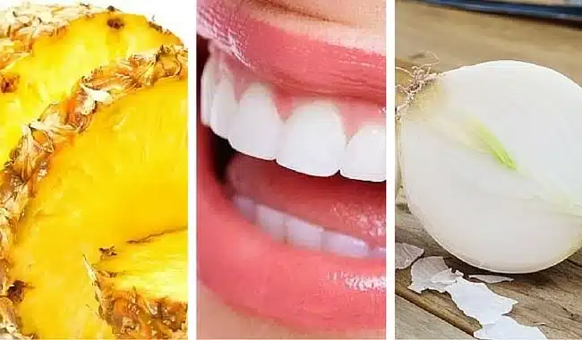 alimentos que ayudan a blanquear los dientes