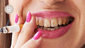 como afecta el tabaco en los dientes