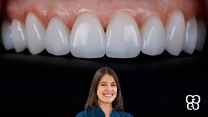 Estetica dental en embajadores