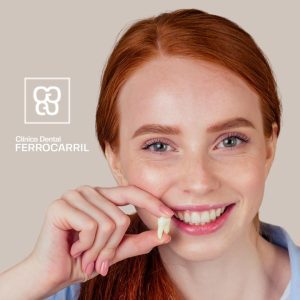 Extraccion sin dolor Clinica Dental Ferrocarril Arganzuela Dentista arganzuela