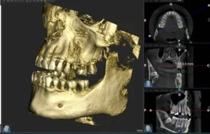 tac 3d dental
