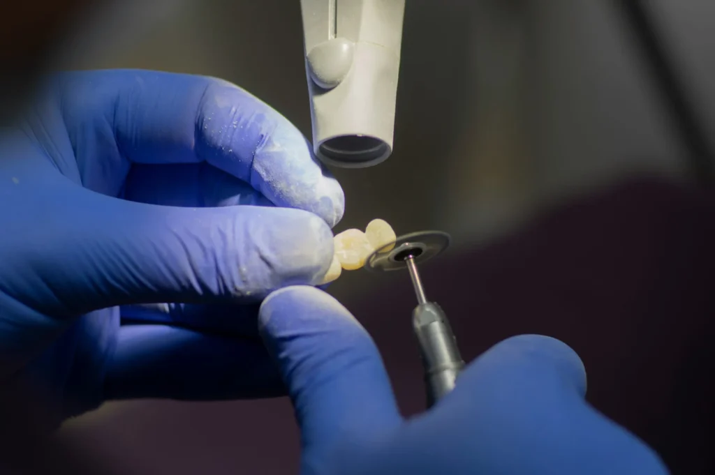 Alergias a materiales dentales
