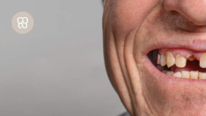 muchos años sin dientes