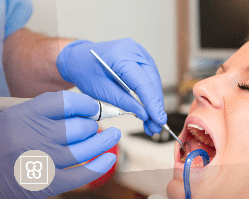 Sarro dental cómo eliminarlo