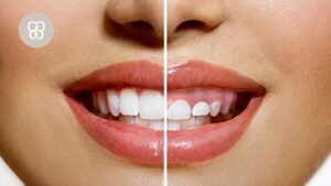 encías y estética clínica dental ferrocarril