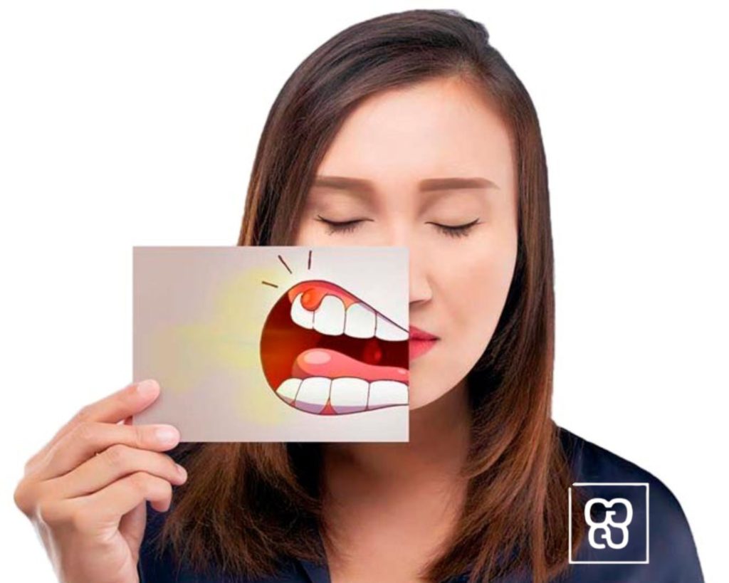 Enfermedad periodontal
