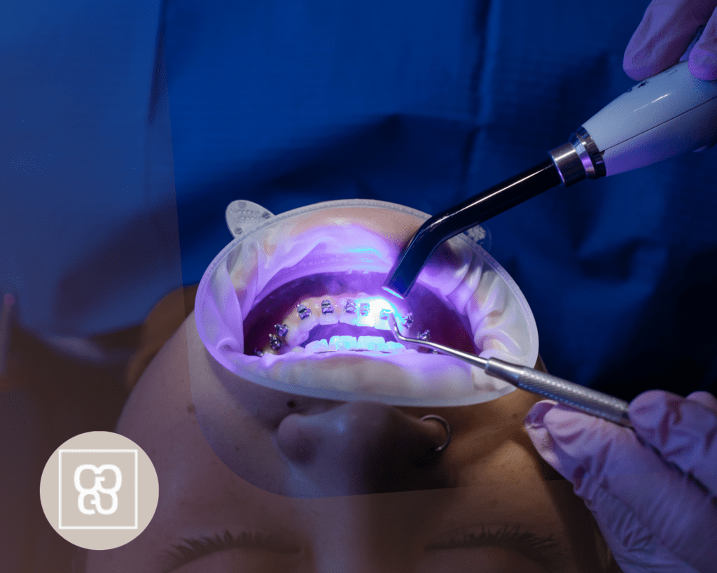 tratamiento dental en españa