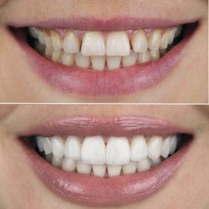 Estetica dental en arganzuela