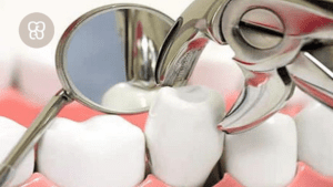 exodoncia en clínica dental Ferrocarril