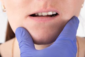 maloclusión dental