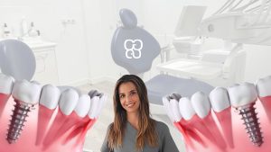 arganzuela implante dental