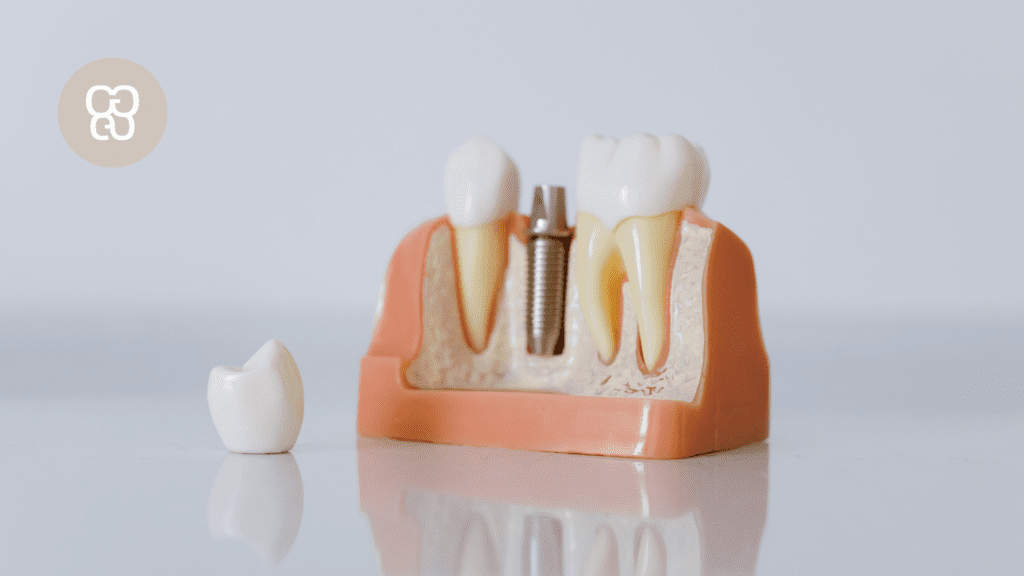 implante dental sin dolor