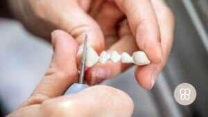 mecánico dental en ferrocarril
