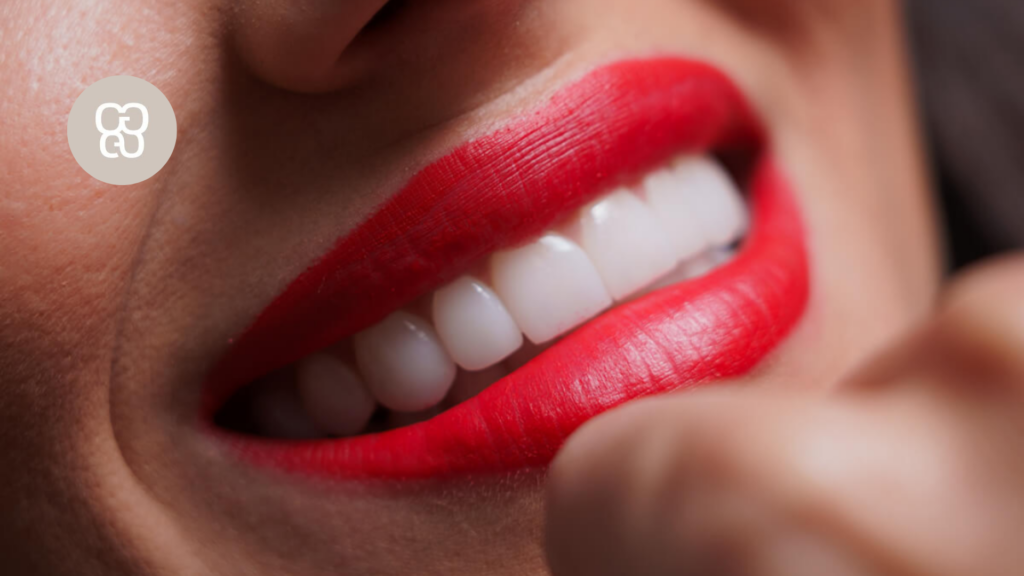 mejores carillas dentales