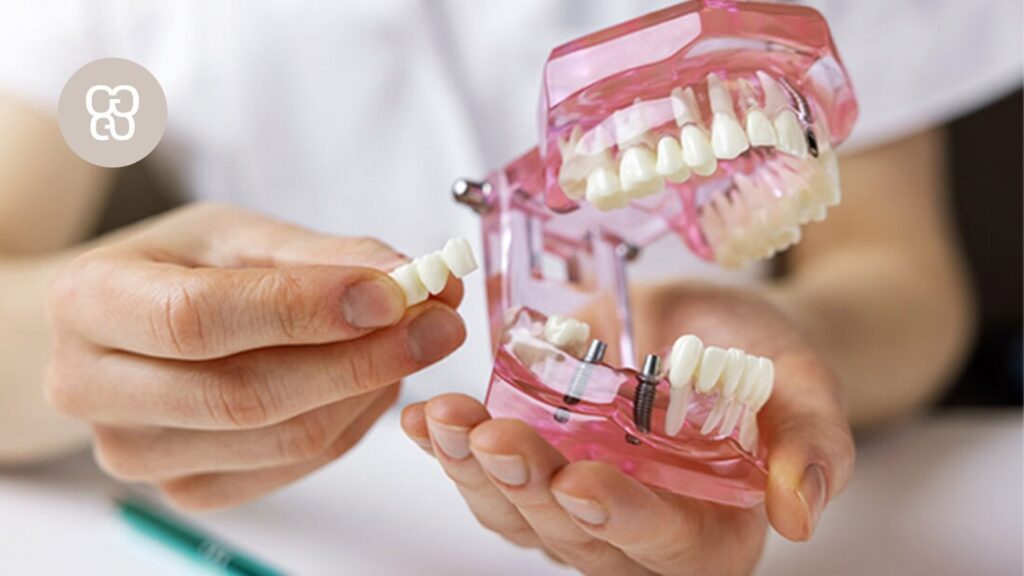 menor tiempo de colocación de implantes dentales clínica ferrocarril