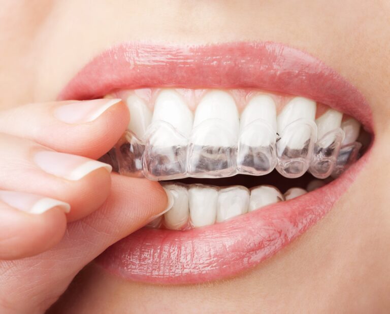 Ortodoncia en Clínica Dental Ferrocarril