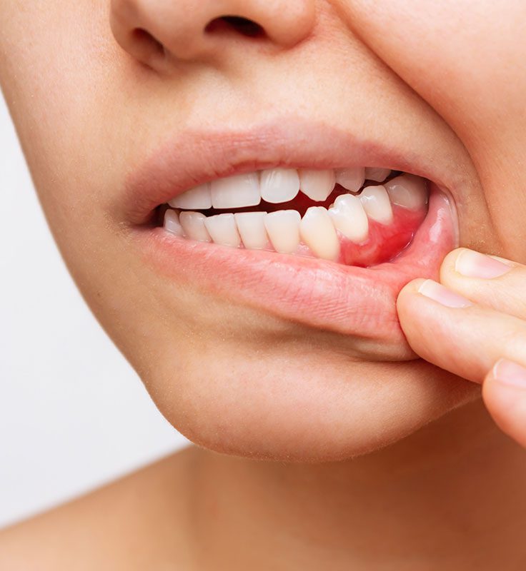 periodoncia en clínica dental ferrocarril