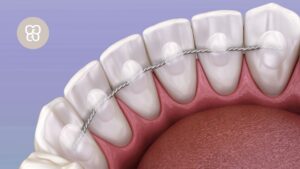 retenedores clínica dental ferrocarril