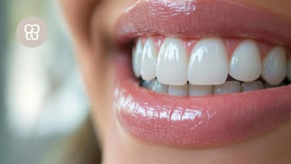 sonrisa perfecta carillas dentales